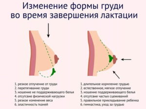 Мелкие камни в груди после гв