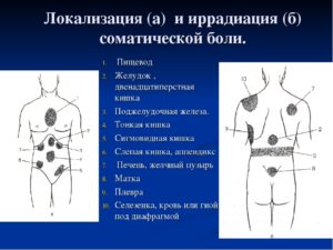 Боль в желудке с иррадиацией