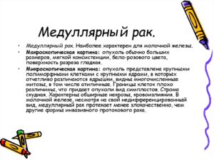 Медуллярный рак