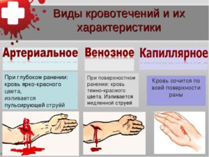 Как остановить кровь