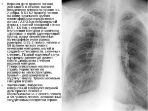 Локальный фиброз н/доли справа