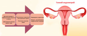 Планирование беременности и тонкий эндометрий