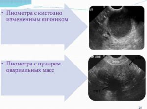 Кистозные изменения яичников