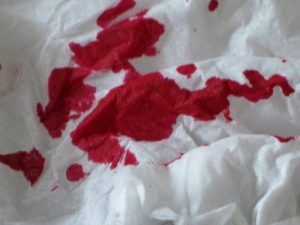 Кровавое пятно на нижнем белье причины