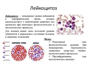 Лейкоциты в крови при аллергии