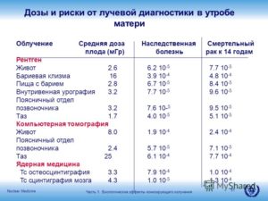 Большая ли лучевая нагрузка