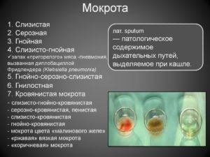 Какие анализы сдать при слизи в горле?