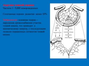 Пересадка тонкой кишки новорожденному