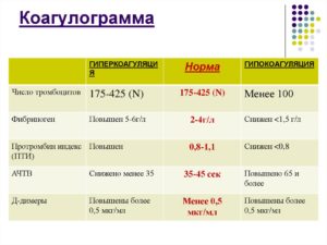 Коагулограмма перед операцией