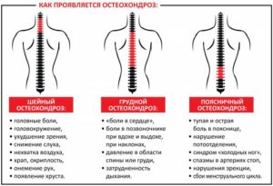 Ломит поясницу и температура