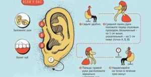 Болит ухо при Беременности