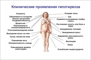 Как влияет удаление щитовидной железы на половую функцию мужчины