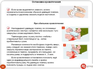 Как остановить кровь