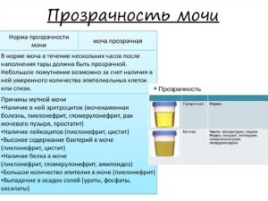 Боли при мочеиспускании, мутная моча