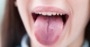 Болит горло и обложен язык