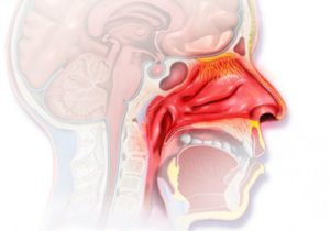 Периодическая слизь в горле, вазомоторный ринит
