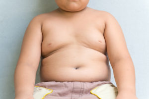 Лишний вес у ребенка