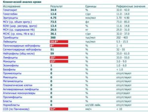 Лейкоциты 3.99 нейрофилы 41.8 лимфоциты 43.9