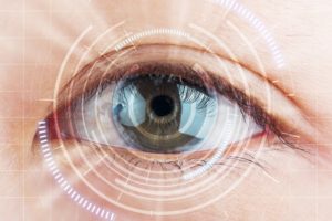 Контактные линзы при катаракте