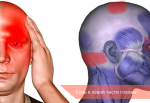 Боль в левом ухе и левой части головы