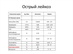 Лейкоз 1 степени по анализу крови