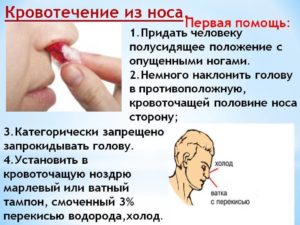 Кровотечение из носа и головокружение