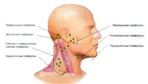 Лимфоузлы подчелюстные