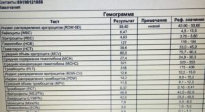 Индекс распределения эритроцитов (RDW-SD) понижен