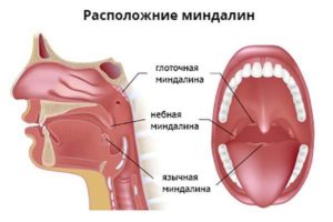 Хронический тонзиллит. Температура 37, просыпаюсь в мокром поту