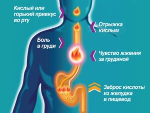 Боль при отрыжке