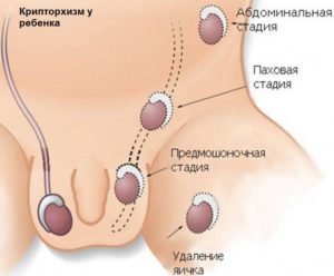 Перемещаются яички в паховую обл.