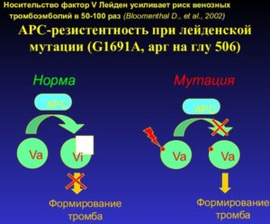 Планирование беременности с мутацией Лейдена гетерозигота