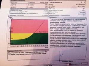 Комбинированный риск на Трисотомию21 1: 60