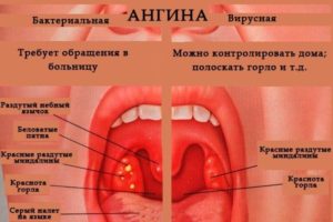 Можно ли купаться сразу после температуры и боли в горле