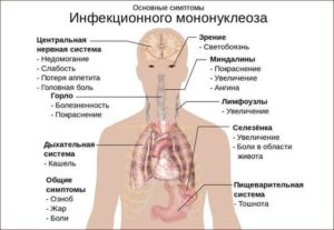 Болит горло, высокая температура (5 суток) тошнота