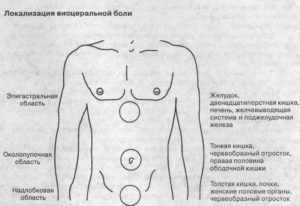 Боли в животе в эпигастральной области