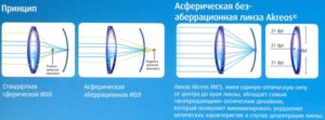 Искусственные хрусталики разной оптической силы