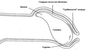 Маленькая дырочка в уздечке полового члена