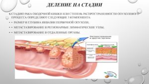 Карцинома 3в стадии или нет