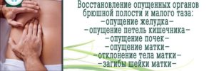 Какие исследования нужны при подозрении на опущение внутренних органов