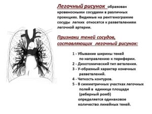 Легочный рисунок неравномерно обогащен