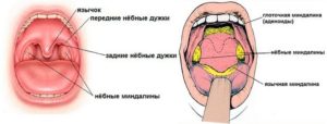 Болит горло, уши, образования на небных дужках