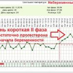 Боль в области сердца под и над левой грудью