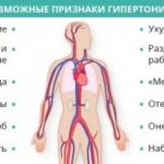 Как срочно нужна операция при узловом зобе?