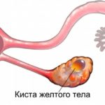 Какая то красная шишка на спине