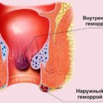 Боль в шее и в грудной клетке