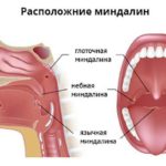 Боль в плечевом суставе, синдром прижатия надостной мышцы