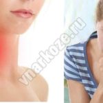 Периоральный дерматит при грудном вскармливании