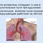 Коллоидные узлы в щитовидной железе