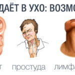 Болит ягодица, поясница